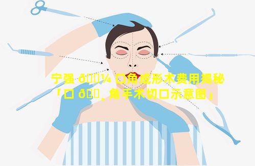 宁强 🐼 口角成形术费用揭秘「口 🕸 角手术切口示意图」